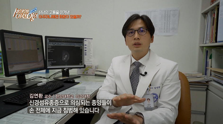 [세상에 이런 일이] 풍선처럼 부푼 손